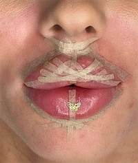 O 0844 25 image2 web